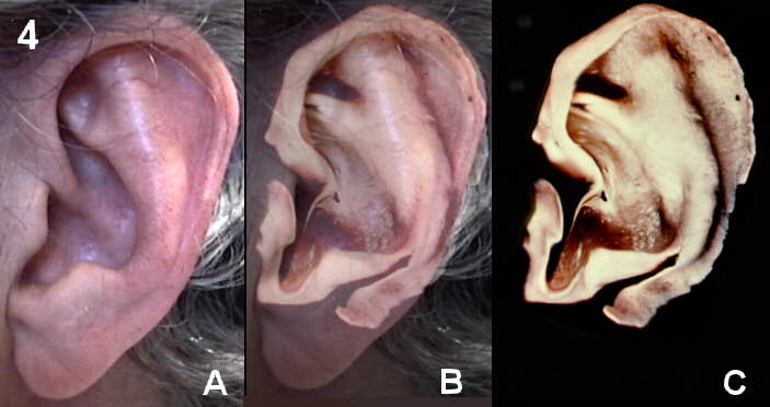 Auricular cartilage